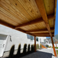 Timber Ridge Patio Cover